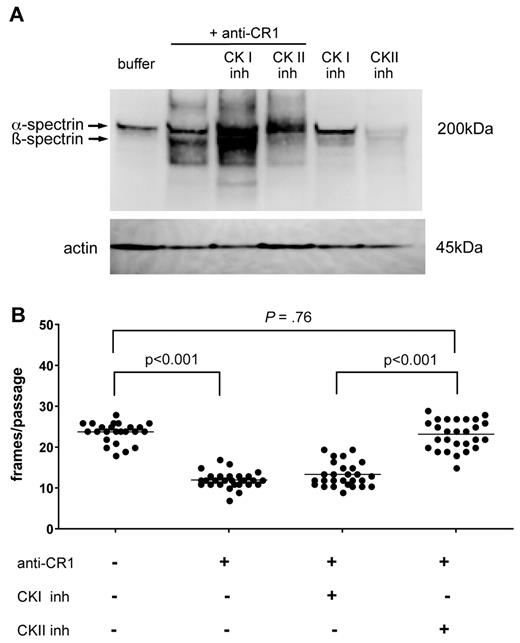 Figure 5. Ligation of CR1 promotes β-spectrin serine phosphorylation through a CK II-dependent mechanism. (A) RBCs were incubated with anti-CR1 mAb in the presence or absence of CK I or CK II inhibitors for 15 minutes at 4°C. RBCs were then washed and cross-linked for an additional 15 minutes with goat anti-mouse secondary Ab at 37°C. RBCs were washed, lysed, and tested for serine phosphorylation by immunoblotting with an anti-phospho-serine/-threonine Ab. Bottom panel shows β-actin as loading control. The experiments were done twice with similar results. (B) Inhibition of CK II blocks the effect of CR1 ligation on RBC membrane deformability. RBCs were incubated with anti-CR1 mAb followed by secondary cross-linking Ab in the presence of CK I or CKII inhibitors, and deformability was tested using microfluidic devices within 15 minutes. These results are representative of 2 independent experiments
