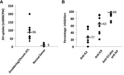Figure 2. IL-2 and IL-9 were secreted by smoldering/chronic ATL PBMCs. (A) NK-92 cell-line assay of 6-day culture supernatants of smoldering/chronic ATL PBMCs (n = 11) and normal donor PBMCs (n = 20). (B) NK-92 cell-line assay of supernatants from 6-day cultures of smoldering/chronic ATL PBMCs in the presence of 10 μg/mL anti–IL-2, anti–IL-9, and the combination of anti–IL-2 and anti–IL-9. Percentage inhibition of NK-92 cell proliferation was calculated by comparing the proliferation with antibodies to that without any antibody.