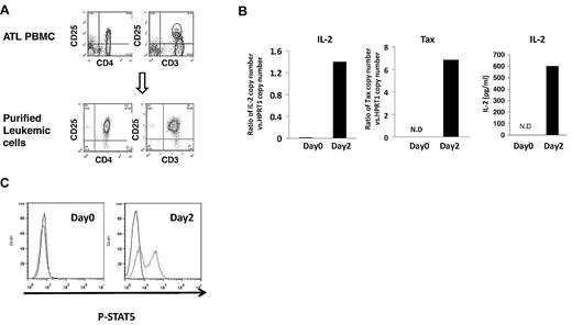 Figure 4. Autocrine IL-2 stimulation in the leukemic cells from smoldering/chronic ATL PBMCs. (A) FACS analysis of CD4, CD25, and CD3 expression of purified leukemic cells and PBMCs from patients with smoldering/chronic ATL. The data are representative of data from 4 independent experiments. (B) IL-2 and Tax mRNA expression by purified leukemic cells cultured alone for 2 days by TaqMan real-time RT-PCR. The copy numbers of IL-2 and Tax mRNA were normalized to the copy number of hypoxanthine guanine phosphoribosyl transferase 1 (HPRT1) mRNA. The IL-2 levels in the supernatants of 2-day purified leukemic cell cultures were also measured by ELISA. N.D: not detected. (C) FACS analysis of phospho-STAT5 in the purified leukemic cells at day 0 or cultured alone for 2 days in the ex vivo culture.