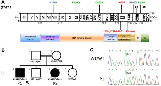 Figure 1. The STAT1 K201N mutation caused susceptibility to mycobacterial and viral infections. (A) The human STAT1 coding region with its known mutations. Coding exons are numbered with Roman numerals and delineated by vertical bars. The N-terminal domain, coiled-coil domain, DNA-binding domain, linker domain, SH2 domain, tail segment domain (TS), and transactivation domain (TD) are indicated, together with their amino acid boundaries. Phosphorylation sites, Tyr 701 (pY) and Ser 727 (pS), are indicated. Mutations in red are recessive mutations associated with complete STAT1 deficiency. Mutations in green are heterozygous mutations associated with partial dominant STAT1 deficiency. Mutations in blue are recessive mutations associated with partial recessive STAT1 deficiency. The mutation reported here is indicated in italics. (B) The pedigree, phenotype, and genotype of the consanguineous kindred from Saudi Arabia. The proband, P1, II.1 is indicated by an arrow, and presented with disseminated M avium infection and disseminated varicella. II.3 had disseminated BCG infection and died of septic shock at the age of 3. These 2 patients are referred to as P1 and P2, respectively. I.1 and I.2 are first cousins. (C) Genomic sequence analysis of exon 8 showing a homozygous G → T mutation in P1, leading to the replacement of a lysine residue by an asparagine residue (K201N/K201N) at position 201 of the protein.