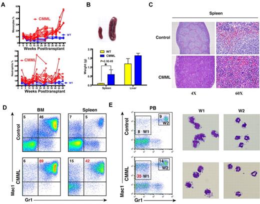 Figure 3. The majority of recipient mice transplanted with whole bone marrow cells expressing oncogenic Nras developed a CMML-like disease. (A) Dynamic percentages of donor-derived monocytes and neutrophils in peripheral blood of diseased mice transplanted with Nras G12D cells or control mice transplanted with control cells. (B) Splenomegaly and hepatomegaly in diseased mice. (Top) Splenomegaly in a representative recipient mouse that developed a CMML-like disease. (Bottom) Results are presented as averages of spleen weights or liver weights + SD. (C) Representative histologic hematoxylin and eosin–stained sections from spleen showed an extensive infiltration of myelomonocytic cells and extramedullary hematopoiesis in recipient mice transplanted with bone marrow cells expressing oncogenic Nras. (D) Flow cytometric analysis of bone marrow cells and splenocytes using myeloid specific markers (Mac1 and Gr1). The percentages of monocytic (top left) and granulocytic (top right) lineages of cells are indicated on the plots. Representative data from 8 CMML mice are shown. (E) Quantification of monocytes (W1) and neutrophils (W2) in peripheral blood were based on their surface expression of Mac1 and Gr1. The right panels show May-Grunwald Giemsa–stained cytospin preparations of cells sorted from W1 and W2 regions to confirm the identities of cells.