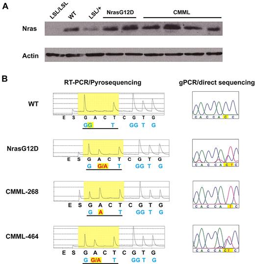Figure 6. A fraction of CMML mice acquire uniparental disomy of oncogenic Nras allele. (A) Western blot analysis of total Nras expression levels in bone marrow cells from representative animals. Note: Nras expression is completely absent in LSL/LSL mice due to the stop cassette, whereas Nras expression in LSL/+ mice is half of that of wild-type (WT) mice. (B) Total RNA and genomic DNA were extracted from bone marrow cells. Pyrosequencing of RT-PCR amplified products and direct sequencing of genomic PCR products at the G12 codon in representative animals are shown. The wild-type and mutated nucleotides are highlighted in yellow.