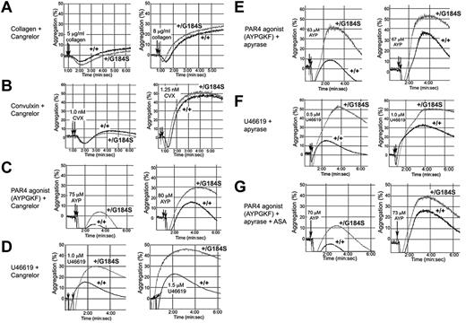 Figure 3. Secreted ADP accounts for the enhanced response of Gi2α(+/G184S) platelets to collagen but not thrombin or TxA2. Platelet aggregation was measured in response to each of the agonists indicated in the presence of a P2Y12 antagonist (Cangrelor), an ADPase (apyrase), and/or a cyclo-oxygenase inhibitor, aspirin (ASA). Representative tracings are shown. The number of times each comparison was performed and the number of mouse pairs used in each part of the figure was (A) 13 times with blood from 2 pairs of mice, (B) 13 times with 2 pairs of mice, (C) 9 times with 2 pairs of mice, (D) 12 times with 4 pairs of mice, (E) 10 times with 2 pairs of mice, (F) 9 times with 2 pairs of mice, and (G) 10 times with 2 pairs of mice.
