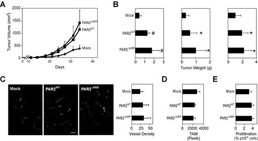 Figure 2. Breast Cancer PAR2 signaling promotes tumor growth and angiogenesis. (A) Typical experiment of orthotopic tumor growth of C57BL/6 mammary fat pad implanted mock, PAR2WT, or PAR2ΔARR transduced PyMT PAR2−/− breast cancer cells (5 × 105/mouse). Tumor volumes are mean ± SD, n ≥ 7 mice/group, P < .05 different from mock by ANOVA. (B) Final tumor weights from 3 independent experiments, mean ± SD, n ≥ 7 mice/group, *P < .05; #P < .001 different from mock by ANOVA. (C) Vessel density of mock, PAR2WT, or PAR2ΔARR tumors was determined on fixed sections stained with CD31. Tumor vessels were quantified with the IMARIS software in at least 4 different areas per tumor, and at least 4 mice/genotypes were analyzed, mean ± SD, * different from mock tumors, P < .05, ANOVA, scale bar 50 μm. (D) Tumor macrophage density was quantified in 4 fields per tumor (n ≥ 3, mean + SEM, P = .5 ANOVA). (E) Phospho Histone 3 and DAPI staining were quantified in at least 4 fields of view with the IMARIS software (n ≥ 4, mean ± SEM, P = .4 ANOVA).