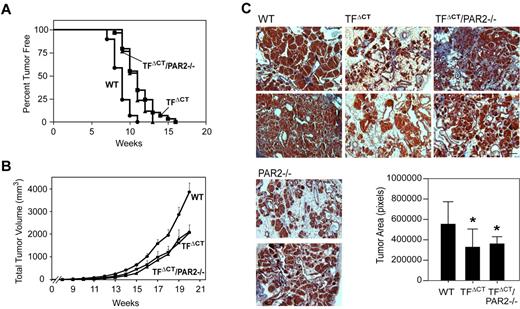 Figure 3. TF cytoplasmic domain deletion impairs spontaneous breast cancer development in the PyMT model. (A) Cohorts of 29 PyMT WT, 29 PyMT TFΔCT, and 17 PyMT TFΔCT/PAR2−/− mice were examined weekly for palpable tumors and tumor incidence was recorded. The mean time for appearance was delayed from 9 weeks for WT to 11 weeks for PyMT TFΔCT, and TFΔCT/PAR2−/− mice (P < .0001 log-rank test). (B) Cumulative tumor burden was determined by weekly measurements of tumor volumes in all mammary glands. PyMT TFΔCT and TFΔCT/PAR2−/− mice had reduced tumor masses relative to WT, mean ± SEM, P < .001 ANOVA Kruskal-Wallis. (C) Tumor progression in 11-13-week-old mice. Detectable tumors were harvested with a similar age distribution in each group. Fixed tumor sections were stained with Masson trichrome and tumor areas were quantified with Image Pro Plus. Tumor areas were smaller in PyMT TFΔCT and TFΔCT/PAR2−/− relative to WT, n ≥ 10, mean ± SD, P < .05 ANOVA. Representative images, scale bar is 100 μm.