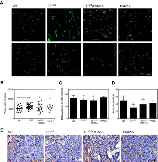 Figure 4. Altered tumor vessel appearance and macrophages recruitment in late stage tumors of TFΔCT mice. Tumors from 20-week-old PyMT WT, TFΔCT, TFΔCT/PAR2−/−, and PAR2−/− mice were stained for CD31 or F4/80. (A) Representative images of CD31 staining in late stage tumors, scale bar 50 μm. (B) CD31 area was quantified using Image Pro plus in 4 different areas of the tumors; n ≥ 5, mean ± SD, P = .02 PyMT WT versus TFΔCT, t test. (C) Tumor vessels coverage was assessed in PDGFRβ and CD31 costained sections, and colocalization of CD31 and PDFGR-β staining was quantified with Imaris in 4 different areas of at least 3 tumors per genotype (*P < .05 by ANOVA). (D) F4/80-positive cells were counted in 4 different tumor areas of at least 5 tumors per genotype, PyMT TFΔCT and TFΔCT/PAR2−/− different from WT, P < .001 ANOVA. (E) Representative images of F4/80-positive cells (brown staining) in PyMT WT, TFΔCT, TFΔCT/PAR2−/−, and PAR2−/− tumors; scale bar is 50 μm.