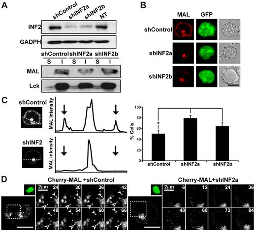Figure 2. INF2 knockdown blocks the exit of MAL vesicles from perinuclear endosomes and decreases the expression of MAL at the plasma membrane. (A-C) Wild-type Jurkat cells (A) or Jurkat cell transiently expressing Cherry-MAL (B-C) were transfected or not (NT) with a DNA construct coexpressing GFP and shControl, or shINF2a or shINF2b, which are targeted to the coding or 3′ untranslated regions, respectively, of INF2 mRNA. Cells were processed for immunoblotting with anti-INF2 antibodies to examine the levels of INF2 or with anti-GADPH antibodies as a loading control (A, top). The 1% Triton-X-100 insoluble (I) membrane fraction of Jurkat cells was separated from the soluble fraction (S), and equivalent aliquots were immunoblotted for MAL and Lck (A bottom). Cells were also processed for fluorescence microscopy to analyze the distribution of MAL (B-C). The intensity of MAL staining in Jurkat cells was measured by densitometric analysis along rectilinear lines as that shown in a representative experiment (C, left). Arrows indicate the position of the periphery of the cell (C middle). The histogram shows the mean percentage ± SEM of cells with low levels of MAL at the plasma membrane as measured as described in “Methods” (C right). Staining intensity was measured in > 50 cells per experiment. Three independent experiments were performed (*P < .05). (D) Jurkat cells transiently expressing Cherry-MAL were transfected with a plasmid coexpressing GFP and shControl or shINF2a for 48 hours, the activity being captured with time-lapse videomicroscopy. Transfected cells were identified by expression of GFP (small top panel). The processes occurring in the cell (large bottom panel) within the boxed region are shown at higher magnification in the right panels. Solid and empty arrowheads indicate 2 vesicles transporting MAL from the pericentriolar region to the plasma membrane or from the plasma membrane to the pericentriolar region, respectively. Numbers indicate time in seconds. Scale bars correspond to 5 μm unless other value is indicated.