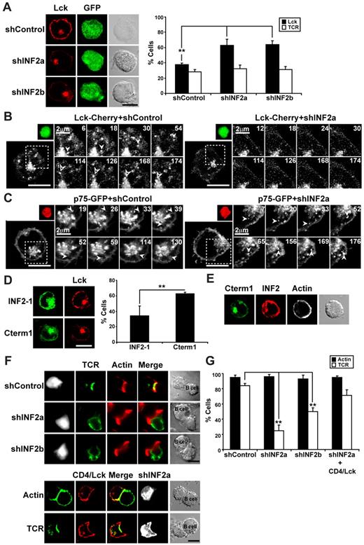 Figure 3. INF2 knockdown blocks the formation of exocytic transport vesicles containing Lck and decreases the expression of Lck at the plasma membrane. (A) The subcellular distribution of endogenous Lck was analyzed in Jurkat cells coexpressing GFP and shControl, shINF2a, or shINF2b using anti-Lck antibodies followed by secondary antibodies coupled to Alexa-647 antibodies. Lck staining intensity was measured by densitometric analysis along rectilinear lines as described for MAL in Figure 2C. The histogram shows the mean percentage ± SEM of cells with low levels of peripheral Lck or TCR/CD3. (B-C) Jurkat cells transiently expressing Lck-Cherry (B) or p75-GFP (C) were cotransfected with a construct coexpressing GFP and shControl or shINF2a (B) or Cherry and shControl or shINF2a (C) for 48 hours, the activity being captured with time-lapse videomicroscopy. Transfected cells were identified by expression of GFP (B) or Cherry (C). The processes occurring in the cell within the boxed regions are shown at higher magnification in the right panels. Arrowheads indicate 2 vesicles transporting Lck to the plasma membrane. Numbers indicate time in seconds. (D) Jurkat cells transiently expressing GFP fusions of INF2-1 or Cterm1 were stained for endogenous Lck using anti-Lck antibodies and secondary antibodies coupled to Alexa-647 (left). The histogram shows the mean percentage ± SEM of cells with low levels of peripheral Lck. (E) Jurkat cells transiently expressing GFP fused to Cterm1 were stained for endogenous INF2 using anti-INF2 antibodies and secondary antibodies coupled to Alexa-594 and with TRITC-phalloidin. The staining of F-actin is presented in gray. (F) Jurkat cells coexpressing GFP (top) and the indicated shRNA or a trasmembrane CD4/Lck chimera (bottom) were conjugated to staphylococcal enterotoxin E–pulsed antigen presenting cells (APCs) for 15 minutes. After cell fixation, the distribution of TCR/CD3 and F-actin was analyzed with anti-CD3 antibodies and secondary antibodies coupled to Alexa-647 and with TRITC-phalloidin, respectively. The staining of TCR/CD3 was pseudocolored in green and that of GFP in gray to help visualization of the distribution of TCR/CD3. The cells expressing CD4/Lck were identified with anti–mouse CD4 mAb and secondary antibodies coupled to Alexa-488 (bottom). (G) The histogram represents the mean percentage of transfected Jurkat cells in T-cell–APC conjugates displaying polarized distribution of F-actin or TCR/CD3 to the IS. Three independent experiments were performed in panels A, D, G; n > 50 T cells/experiment (**P < .01). Scale bars correspond to 5 μm unless other value is indicated.