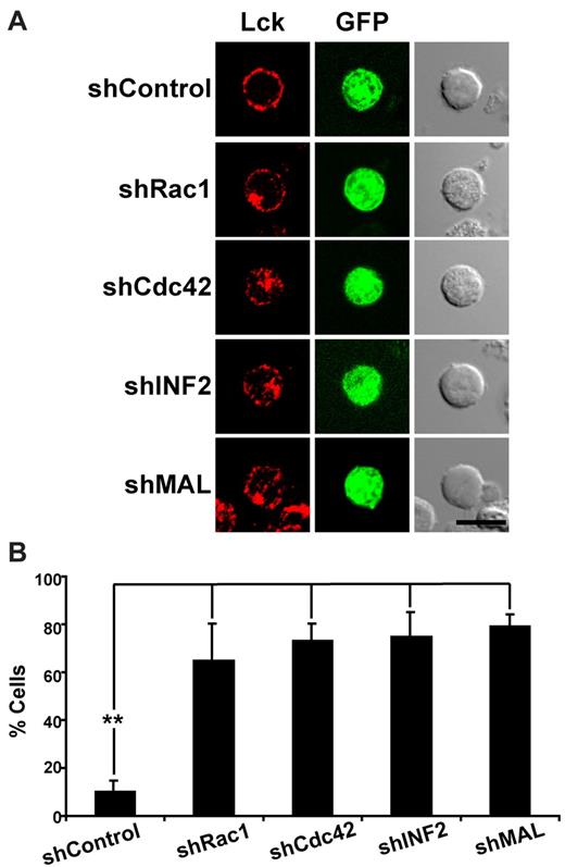 Figure 7. Cdc42, Rac1 and INF2 are necessary for targeting of Lck to the plasma membrane in human primary T cells. (A) Human primary T cells expressing GFP and shControl or shRNA targeted to Rac1, Cdc42, INF2, or MAL from the same plasmid were fixed, permeabilized, and stained for Lck using anti-Lck antibodies and secondary antibodies coupled to Alexa-647. Note that Lck is almost exclusively detected at the plasma membrane in control primary T cells. (B) The histogram represents the mean percentage ± SEM of cells with an intracellular accumulation of Lck. Three independent experiments were performed; > 50 transfected cells were scored in each experiment (**P < .01). Scale bar indicates 5 μm.