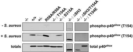 Figure 6. Phosphorylation of p40phox on T154 is unaffected in p40phox-R58A, -S315A, or -ΔSH3 neutrophils. p40phox−/− (−/−), wt (+/+), p40phox+/− (+/−), p40phoxR58A/R58A (R58A/R58A) BMNs, or p40phox−/− BMNs reconstituted with mutated versions of p40phox as indicated were incubated without or with S aureus (ratio S aureus/BMN of 20:1) for 20 minutes at 37°C. Cell lysates were subjected to SDS-PAGE, after which immunoblotting was performed using an antibody directed against p40phox phosphorylated on T154 or total p40phox as a loading control. Representative blots from 2-5 independent experiments are shown.