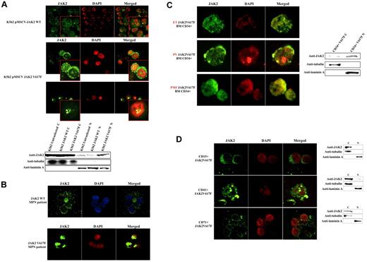 Figure 1. V617F mutation favors nuclear translocation of JAK2 in K562 and early CD34+ progenitors isolated from BM of MPN patients. This translocation is not observed in differentiated cells. (A) CIF microscopy images of K562 cells stably transfected with pMSCV-JAK2 (top-row images) or pMSCV-JAK2V617F (second- and third-row images) Western blotting of cytoplasmic (C) and nuclear (N) fractions (bottom) confirm that JAK2V617F is more abundant than JAK2 in K562 nuclei. (B) CIF images of BM cells from an MPN patient with wt JAK2 (top row) and an MPN patient with JAK2V617F (bottom row) confirm a nuclear increase of the mutated protein. (C) CIF demonstrates a predominantly nuclear accumulation of JAK2V617F in CD34+ cells isolated from BM of 1 essential thrombocythemia (ET), 1 polycythemia vera (PV), and 1 early primary myelofibrosis (PMF) (left panels). Western blotting of cytoplasmic (C) and nuclear (N) extracts (right) confirm the data. (D) CIF images of CD15+, CD41+, CD71+ cells isolated from a JAK2V617F-positive MPN patient (PV, JAK2 allele burden 71%) and Western blotting of cytoplasmic (C) and nuclear (N) extracts (right). DAPI, 4,6-diamidino-2-phenylindole; Anti-JAK2 (Cell Signaling Technology) monoclonal antibody; anti-tubulin and anti-laminin A (Sigma-Aldrich) monoclonal antibodies.