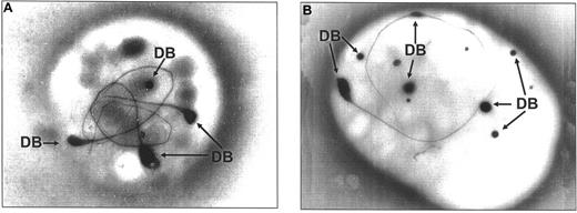 Figure 1. Whole-mounted platelets viewed by TEM. Two micrographs (A-B) of whole-mounted platelets viewed by TEM contain many spherical dense bodies (DBs) and DBs with 1 or 2 tails.
