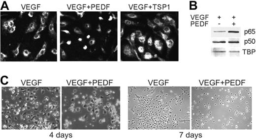 Figure 2. Angiogenic inhibitors activate NF-κB in endothelial precursor cells. (A-B) NF-κB nuclear localization in bone marrow endothelial progenitor cells (EPCs) stimulated to differentiate for 7 days with VEGF (10 ng/mL) and treated with TSP1 (100nM) or PEDF (10nM) was visualized by immunostaining for p65 (A) and measured by Western blot analysis of nuclear extracts for p65 (top) and p50 (middle; B). Loading was assessed by TBP (bottom). Three independent experiments were performed with similar results. (C) EPC colony formation with and without PEDF (10nM). Images were viewed with a Nikon Eclipse TE 2000-U microscope with a 40×/0.60 air objective and Fluoromount G imaging medium (Southern Biotech), and captured with a Nikon LH-M100 C-1 camera. Metamorph, Adobe Photoshop CS3 Extended Version 10.01, and Corel Photo-Paint 10 software were used.