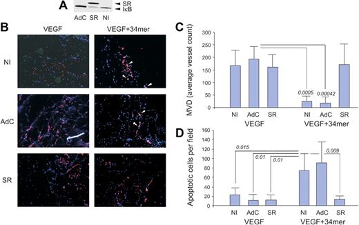 Figure 4. The IκB super-repressor blocks PEDF-induced antiangiogenesis in vivo. HMVECs were infected with adenoviral vector expressing IκB super-repressor (SR) or with control adenoviral vector expressing β-Gal (AdC). Noninfected HMVECs (NI) were used as control. Total cell extracts were collected and analyzed by Western blot for IκB (A). Note decreased endogenous IκB levels on IκB-SR overexpression. (B) HMVECs, noninfected or infected with AdSR or AdC, were incorporated into subcutaneous Matrigel plugs implanted in nude mice. Angiogenesis was induced with VEGF (200 ng/mL) and blocked by 100nM of the PEDF 34-mer peptide (both incorporated in the Matrigel). At the completion of experiment, the plugs were stained for CD31 (red), apoptosis was visualized by in situ TUNEL (green), and the nuclei highlighted with 4,6-diamidino-2-phenylindole (blue). Apoptotic cells appear white because of superimposed blue, red, and green (white arrows). Images were viewed with a Nikon Eclipse TE 2000-U microscope with a 10×/0.45 objective and Fluoromount G imaging medium (Southern Biotech), and captured with a Nikon LH-M100 C-1 camera. Metamorph, Adobe Photoshop CS3 Extended Version 10.01, and Corel Photo-Paint 10 software were used. (C) Digital images were taken and microvessel density evaluated using MetaMorph software. P values are shown. (D) Apoptosis evaluated on digital images with MetaMorph software. P values were determined by analysis of variance.