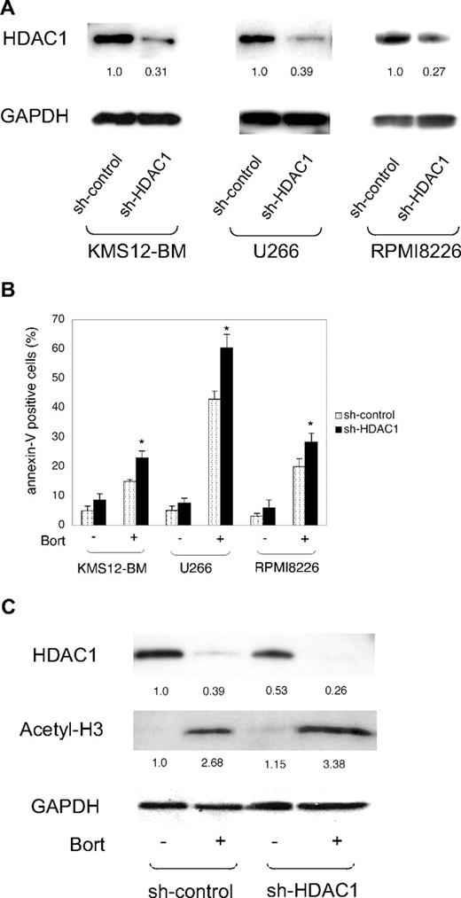 Figure 4. Effects of shRNA-mediated knockdown of HDAC1 on bortezomib-induced apoptosis in MM cells. (A) MM cell lines were transfected with either pLL3.7-sh-HDAC1 (sh-HDAC1) or sh-control vector. Whole-cell lysates were prepared from GFP+ cells collected using a FACSAria flow cytometer and subjected to immunoblotting. The signal intensities of each band were quantified, normalized to those of the corresponding GAPDH, and shown as relative values setting the sh-control to 1.0. (B) MM cell lines transfected with shRNA vectors were cultured in the absence or presence of 2nM bortezomib. After 48 hours, MM cells were harvested, stained with annexin-V/APC, and subjected to flow cytometric analysis. The y-axis shows the proportion of annexin-V positivity in the GFP+ fraction. The means ± SD (bars) of 3 independent experiments are shown. P values were calculated by 1-way ANOVA with the Student-Newman-Keuls multiple comparisons test. *P < .05 against the sh-control. (C) shRNA-transduced RPMI8226 cells were cultured in the absence or presence of 2nM bortezomib. After 48 hours, whole-cell lysates were prepared from GFP+ cells collected by the FACSAria flow cytometer, and subjected to immunoblotting. The signal intensities of each band were quantified, normalized to those of the corresponding GAPDH, and shown as relative values setting the untreated sh-control to 1.0.