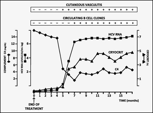 Figure 4. Chronologic relationships among cutaneous vasculitis, viral load (HCV RNA), cryocrit percentage, serum C4 level, and B-cell clonalities in a representative patient (male, 61 years) who relapsed.