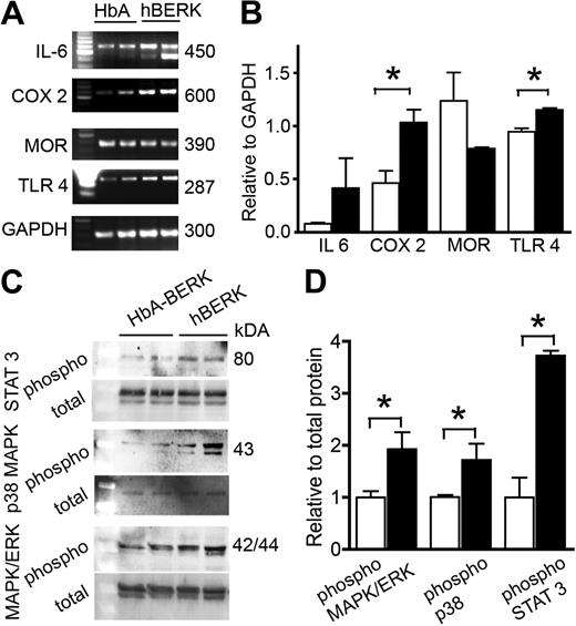 Figure 7. Expression of inflammatory and neurochemical mediators in the spinal cords of male hBERK1 mice. (A-B) mRNA expression using semiquantitative reverse-transcribed polymerase chain reaction. GAPDH expression shows the loading control. The first lane indicates size markers. (B) Bar represents band density for each product relative to band density of GAPDH. (C-D) Expression of phosphorylated and total proteins (MAPK/ERK, p38 MAPK, and STAT3) determined using Western immunoblotting. Bar represents band density of individual phosphoprotein relative to its total protein. (B,D) Data are the mean ± SEM of 4 separate experiments. ■ represents hBERK1 mice; □, HbA-BERK mice. *P < .05.