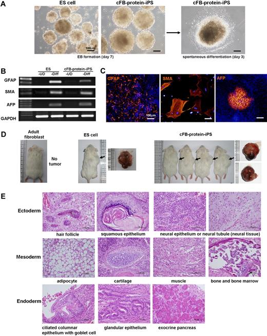Figure 3. In vitro and in vivo differentiation potentials of the protein-iPS cells. (A) EB formation by suspension culture (left), followed by the attachment of EB onto gelatin-coated dishes for the induction of spontaneous differentiation induction (right). (B-C) Seven to 14 days after commencing spontaneous differentiation, cells were harvested, and RT-PCR (B) and immunocytochemistry (C) were performed. UD, undifferentiated; Diff, spontaneous differentiation; GFAP, glial fibrillary acidic protein; SMA, α-smooth muscle actin; AFP, α-fetoprotein. DAPI (4′,6-Diamidino-2-phenylindole; blue) for nuclei. (D) cFB-protein-iPS cells were injected into NOD/SID mice. Adult fibroblasts and ES cells served as controls. Four weeks later, tumors were harvested (arrows). Gross morphologies showed well-demarcated tumors. (E) Hematoxylin and eosin (H&E) staining of a tumor from cFB-protein-iPS cells showing a well-differentiated teratoma.