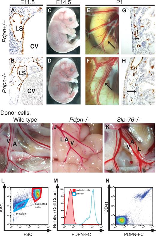 Figure 1. Podoplanin is required in nonhematopoietic cells for blood-lymphatic separation. (A-H) Pdpn−/− animals exhibit vascular mixing phenotypes identical to those of Slp-76−/− animals. (A-B) Development of blood-filled lymph sacs in E11.5 Pdpn−/− embryos. (C-D) Blood-filled cutaneous lymphatics are visible in E14.5 Pdpn−/− embryos. (E-F) Blood-filled mesenteric lymphatics in Pdpn−/− neonatal animals (arrows) are shown. (G-H) Histologic evidence of intestinal edema in neonatal animals (double arrows) is shown. Immunostaining for LYVE-1+ lymphatic endothelium is shown (A-B,G-H). CV indicates cardinal vein; and LS, lymph sac. (I-K) Blood-filled mesenteric lymphatic vessels arise in lethally irradiated wild-type mice after reconstitution with Slp-76−/− (K) but not wild-type (I) or Pdpn−/− (J) donor hematopoietic cells. A indicates artery; V, vein; and L, lymphatic. (L-N) PDPN-Fc fusion protein selectively binds platelets in whole blood. Binding of PDPN-Fc to anuclear platelets vs nucleated blood cells is shown with the use of forward and side scatter (FSC and SSC) on a log scale to discriminate the 2 cell populations (L; gated cell populations are indicated by purple boxes). All PDPN-bound cells express the platelet-specific integrin CD41 (M-N).