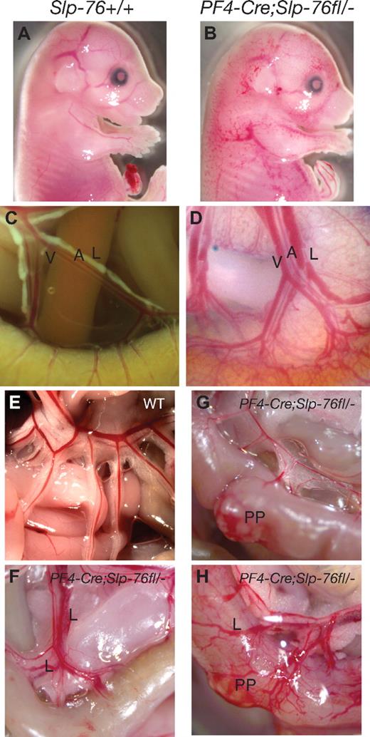 Figure 4. SLP-76 is required in platelets for normal lymphatic vascular development. (A-B) PF4-Cre;Slp-76fl/− embryos exhibit blood-filled cutaneous lymphatics. (C-D) PF4-Cre;Slp-76fl/− neonates exhibit blood-filled mesenteric and intestinal lymphatic vessels. A indicates artery; V, vein; and L, lymphatic. (E-H) Twelve-week-old PF4-Cre;Slp-76fl/− animals exhibit vascular mixing phenotypes that range in severity from blood-filled Peyer patches (PP, left) to disruption of the normal vascular pattern of the intestine wall and blood-filled mesenteric lymphatic vessels (L, right).