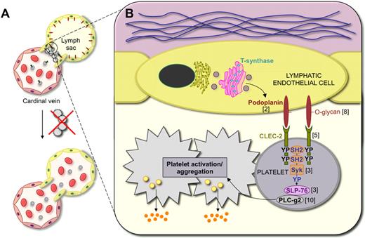 A schematic view of the mechanisms of blood vessel–lymphatic vessel separation. (A) In embryos, the lymphatic vessels develop from embryonic veins. The junction between the anterior cardinal vein and the first lymphatic vessel structure, called the lymph sac, is closed by a platelet plug. However, various defects of platelets allow blood entry into the lymphatic vessels. (B) Podoplanin is O-glycosylated during its biosynthesis in lymphatic endothelial cells. Cell surface–exposed podoplanin provides binding sites for the platelet receptor CLEC-2. Podoplanin-bound CLEC-2 activates the Syk tyrosine kinase and SLP-76 adaptor protein, which leads to downstream activation of phospholipase C-gamma2 (PLC-g2), with resulting platelet activation including release of platelet alpha granules. The numbers next to the various molecules correspond to the references reporting the deletion phenotypes, for example, PLC-g2.10