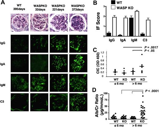 Figure 2. Immune complex deposition and mesangial cell proliferation in WASp-deficient mice. (A) Representative PAS-stained glomeruli from WASp-deficient and 129 SvEv control mice and immunofluorescence images of IgA, IgG, IgM, and C3 deposition in glomeruli from the same animals. (B) Quantitation of immunofluorescence results from mice of the indicated genotype more than 6 months old measured as in panel B. (C) Circulating immune complexes in mice of the indicated genotypes and ages. (D) Urinary albumin/creatinine ratios in a cohort of WASp-deficient and 129 age-matched control mice.