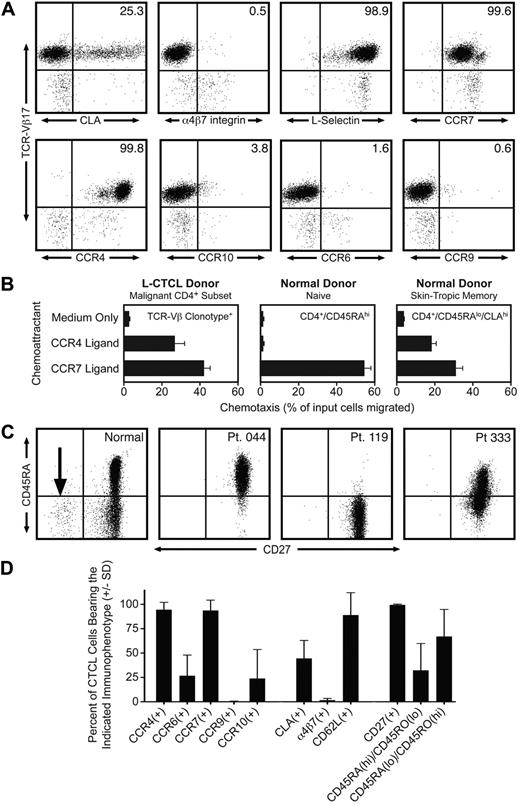 Figure 1. Malignant T cells from the blood of patients with L-CTCL have a central memory T-cell phenotype. (A) Flow cytometric analysis of clonal malignant T cells isolated from the blood of an L-CTCL patient with a TCR-Vβ17 malignant clone demonstrated that malignant T cells expressed high levels of the central memory T-cell markers L-selectin and CCR7. CCR4 was also expressed at high levels, but expression of other skin homing addressins (CLA, CCR6, and CCR10) was variable. There was no detectable expression of the gut homing addressins α4β7-integrin and CCR9. (B) CCR4 and CCR7 expressed by malignant T cells in L-CTCL were functional as demonstrated by their ability to support migration to the CCR4 ligand CCL22 and the CCR7 ligand CCL21 in in vitro T-cell migration assays. Shown are the mean ± SD migration of clonal malignant T cells from 3 L-CTCL donors (left panel) and the naive (center panel) and CLA+ memory T cells (right panel) from 3 normal donors. As expected, normal naive T cells responded only to CCR7 ligand. (C) Clonal malignant T cells from L-CTCL patients expressed high levels of CD27, consistent with a central memory T-cell phenotype, but expression of CD45RA varied among patients. CD4+ CD3+ T cells from a normal donor are shown on the left. The CD27-negative effector T-cell population observed in normal donors is indicated by an arrow. The right 3 panels show 3 L-CTCL patients, and histograms are gated to show only the CD4+ clonal malignant T-cell populations. CD27 was uniformly expressed on malignant cells from all donors, but the expression of CD45RA was variable. (D) Analysis of 11 additional L-CTCL patients with identifiable malignant clones produced similar results. Shown are the mean ± SD of surface marker expression of the CD3+/CD4+ cells expressing the expanded TCR-Vβ clonotype.