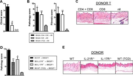Figure 6. Cutaneous GVHD is CD4-independent but requires signaling through the donor IL-17 and IL-21 receptor. (A) Clinical scores 6 weeks after transplantation of lethally irradiated B6 recipients (n = 10 per group) of G-CSF–mobilized BALB/c.WT grafts containing both CD4 and CD8 T cells or equivalent numbers of CD8 T cells only. A non-GVHD control group received TCD G-CSF–mobilized splenocytes only (n = 6). ΦP < .001, CD4 plus CD8 vs CD8. (B) Semiquantitative histopathology of skin 6 weeks after BMT (n = 9 or 10 per GVHD group and n = 6 in TCD group). **P < .01, *P < .05, CD4 plus CD8 T and CD8 T vs TCD, respectively. (C) Representative histopathology at week 6 after BMT (original magnification ×200). (D) Semiquantitative skin histopathology 5 weeks after transplantation in lethally irradiated B6D2F1 recipients (n = 5-9 per group) transplanted with G-CSF–mobilized B6.WT, B6.IL-21R−/− or B6.IL-17R−/− splenocytes. A non-GVHD control group received B6.WT T-cell-depleted G-CSF–mobilized splenocytes only (n = 4). *P < .05, WT vs IL-21R−/− and IL-17R−/−. (E) Representative histopathology at week 7 after BMT (original magnification ×100).