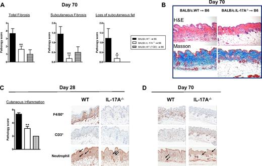 Figure 7. Incidence of scleroderma in the presence or absence of donor-derived IL-17. (A) Lethally irradiated recipient B6 mice were transplanted with grafts from G-CSF–treated WT (n = 9) or IL-17A−/− (n = 11) BALB/c donors. Non-GVHD recipients received T-cell-depleted WT grafts (n = 4). Histologic scoring of parameters of scleroderma 70 days after transplantation as detailed in “Histology and immunostaining of GVHD target organs.” Data represent mean ± SEM pooled from 2 replicate experiments. (B) Representative images (original magnification ×400) of hematoxylin and eosin or Masson (which stains collagen blue) stained paraffin sections of skin taken 70 days after transplantation. (C-D) Lethally irradiated recipient B6 mice were transplanted with grafts from G-CSF–treated WT or IL-17A−/−BALB/c donors (n = 6 per group). Non-GVHD recipients received T-cell-depleted WT grafts (n = 3). Histologic scoring of parameters of inflammation in skin 28 days after transplantation as detailed in “Histology and immunostaining of GVHD target organs.” Representative images of cellular infiltration within skin from B6 recipients of BALB/c grafts from G-CSF–treated WT or IL-17A−/− donors at day 28 and day 70 after SCT. Macrophages (F4/80+) and T cells (CD3+) are stained brown. Neutrophils are stained red (arrow) by chloroacetate esterase Leder stain. **P < .01, *P < .05, WT vs IL-17A−/− grafts.