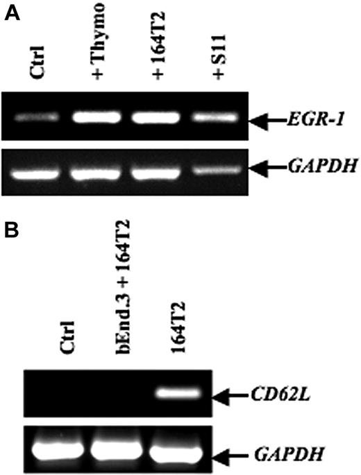 Figure 2. EGR-1–induced expression in endothelial cell lines after contact with T lymphoma cells. (A) After in vitro contact with freshly isolated murine thymocytes, 164T2, or 164T2S11 T lymphoma cell lines, bEnd.3 cells were harvested and total RNA was extracted and then subjected to reverse-transcribed–polymerase chain reaction (RT-PCR) to quantify EGR-1 expression. (B) Expression of L-selectin in bEnd.3 cells after contact with 164T2 T lymphoma cells as a control of bEnd.3 purity after sorting. No expression of L-selectin was detected in bEnd.3 or after purification after coculture with T lymphoma cells. The 164T2 cells were used as a positive control for L-selectin expression. In both panels A and B, the control included bEnd.3 cells incubated without lymphoid cells in the same culture conditions and GAPDH expression was used as internal control. Bars represent SD; *P ≤ .05.