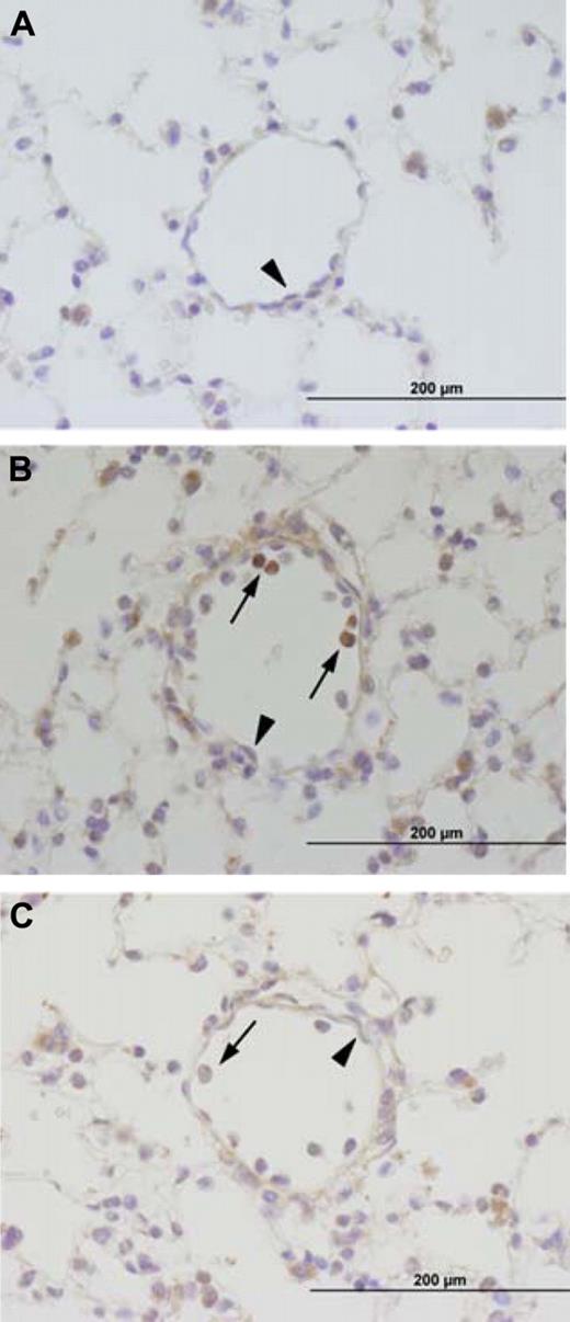 Figure 4. Immunohistochemical analysis of TF expression. TF expression was analyzed in lungs of untreated TFflox/flox mice (A) or TFflox/flox (B) and TFflox/flox,Tie-2Cre (C) mice 8 hours after LPS injection. TF-positive cells are brown. ↑ indicates leukocytes and indicates ECs. Incubation of serial sections with control rat IgG demonstrated no staining (data not shown).