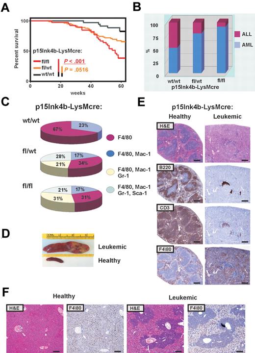 Figure 5. High penetration of retrovirus-induced myeloid leukemia in p15Ink4bfl/fl-LysMcre mice. (A) Kaplan-Meier survival curves for p15Ink4bfl/fl-LysMcre (n = 39), p15Ink4bfl/wt-LysMcre (n = 82), and p15Ink4bwt/wt-LysMcre (n = 35) mice infected with the MOL4070LTR retrovirus. P values were calculated using the log-rank test. (B) Proportion of myeloid and lymphoid leukemia in wild-type (wt/wt) and targeted mice (fl/wt and fl/fl) infected with the retrovirus. (C) Distribution of myeloid leukemia subtypes in targeted and wt mice based on immunophenotype. (D) Representative pictures of a spleen from a clinically healthy mouse and an enlarged leukemic spleen with infiltrated leukemic cells. (E) Histologic analysis of paraffin-embedded sections of clinically healthy and leukemic spleens. Hematoxylin and eosin and immunohistochemical staining using anti-B220 (B220), anti-CD-13 (CD13), and anti-F4/80 (F4/80) are shown. Scale bar represents 400 μm. (F) Histologic analysis of paraffin-embedded sections of clinically healthy and leukemic liver stained with hematoxylin and eosin and anti-F4/80. Scale bar represents 200 μm.