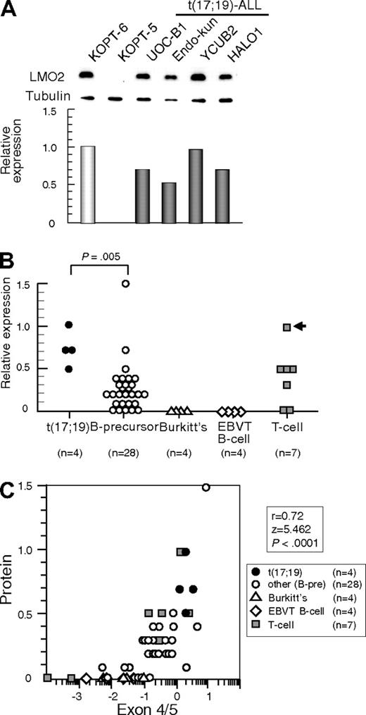 Figure 2. LMO2 protein expression in t(17;19)-ALL. (A) Western blot analysis of LMO2. Relative expression of each cell line was determined by quantifying the intensity of each band using KOPT6, a T-ALL cell line with t(11;14), as a positive control and KOPT-5, a T-ALL cell line without LMO2 expression, as a negative control, and normalized by the level of α-tubulin expression as an internal control. (B) Relative level of LMO2 protein expression. The P value determined by Mann-Whitney test is indicated. (C) Correlation between levels of relative protein expression of LMO2 (vertical axis) and gene expression of LMO2 analyzed by real-time RT-PCR using the primers for exons 4 and 5 (horizontal axis).