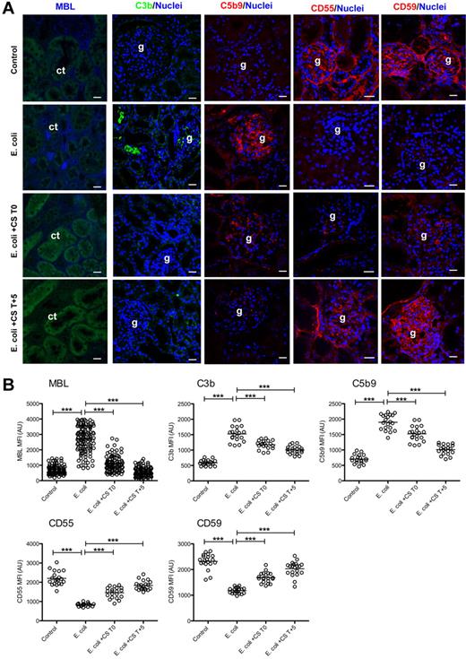 Figure 2. Immunofluorescence confocal imaging and quantitative analysis of fluorescence intensity in kidneys stained for several complement pathway proteins. (A) Micrograph panel showing on columns immunostaining for mannose-binding lectin (MBL) C3b, TCC (C5b9), CD55, and CD59 in (rows) healthy controls, septic baboons (E coli), and septic baboons treated with compstatin (CS) during the first (E coli + CS T0) or the second (E coli +CS T + 5) stage. The color of each antigen is shown on the upper row. To facilitate recognition of microscopical structures, green autofluorescence (first column) or nuclear staining channels (columns 2-5) were collected. Magnification bar, 50μm. (B) Scatter-plot representation of mean fluorescence intensity (MFI) of the images collected for the above-mentioned proteins and experimental conditions. MBL: 20 peritubular capillary ROI in 15 images (200 spots); all other images: whole-field MFI of at least 15 images for each experiment. Scatter-plot data are shown as mean ± SEM. One-way ANOVA with Dunnett multicomparison test; ***P < .001 compared with the E coli group.