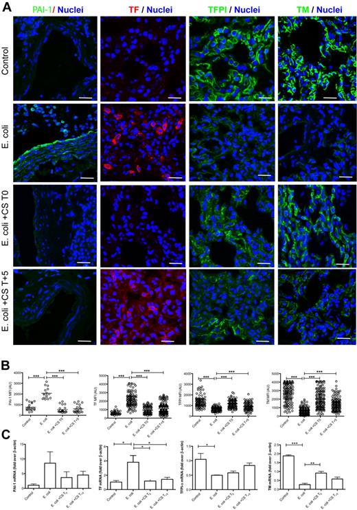 Figure 5. Localization and quantitative analysis of hemostatic proteins in the lung. (A) Micrograph panel showing (columns) immunostaining for PAI-1, tissue factor (TF), TFPI and thrombomodulin (TM) in (rows) healthy controls, septic baboons (E coli), and septic baboons treated with compstatin (CS) during the first (E coli + CS T0) or the second (E coli + CS T + 5) stage. The colors of the each antigen and nuclear counterstaining are shown on the top row. ct indicates convolulted tubules; and g, glomerulus. Magnification bars, 50 μm. (B) Scatter-plot representations of MFI of images collected for the above-mentioned proteins and experimental conditions. PAI-1: whole-field MFI of at least 15 images; all other immunostainings: 20 ROI (alveolar capillaries) in 15 images (200 spots). (C) Histogram representation of mRNA expression for PAI-1, TF, TFPI, and TM. Values indicate the mean ± SEM of fold over β-actin housekeeping gene. In panels B and C, data are presented as mean ± SEM. One-way ANOVA with Dunnett multicomparison test. *P < .05; **P < .001; ***P < .001 compared with E coli group.