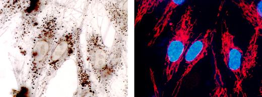 Mesenchymal stromal cells (MSCs) show promise in tissue regeneration. The cells are highly metabolically active as shown by the high numbers of mitochondria (red; right panel) and interact closely with each other as shown in the unstained live cell preparation (left panel).