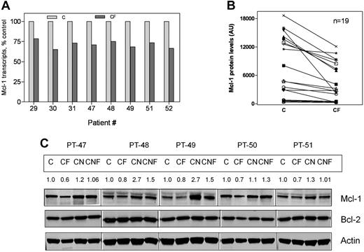 Figure 5. Reduction in Mcl-1 transcript and protein levels in CLL cells after treatment with forodesine and dGuo. CLL cells were incubated with or without 2μM forodesine and 20μM dGuo in suspension or on MSCs. The levels of Mcl-1 transcript (n = 8, A), and Mcl-1 protein (n = 19, B), were measured by real time RT-PCR and immunoblotting analysis, respectively. The Western blot images from 5 representative patients for Mcl-1 and Bcl-2 proteins (C). Actin was used as loading control. C indicates CLL; F, forodesine plus dGuo; M, M210B4; and N, NKtert.
