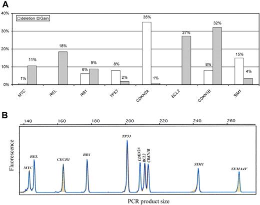 Figure 1. QMPSF assay in DLBCL. (A) Gene copy number abnormality distribution in diffuse large B-cell lymphoma (DLBCL; n = 114). (B) Example of an electropherogam obtained from the quantitative multiplex PCR of short fragments (QMPSF) assay. Tumor and normal QMPSF electropherograms are indicated in blue and orange, respectively. Amplicons are identified according to their expected sizes (x-axis). The heights of the peak (fluorescence; y-axis) are proportional to the amount of corresponding target DNA.