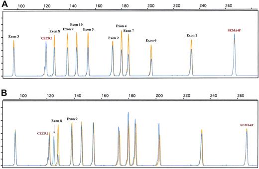 Figure 4. Examples of TP53 genomic alterations detected by a dedicated quantitative QMPSF assay in DLBCL. Tumor and normal QMPSF electropherograms are indicated in blue and orange, respectively. (A) Case 10. This case showed a decrease of the fluorescence of the 10 TP53-related peaks compared with normal DNA and endogenous controls. (B) Case 92. This case displayed an aberrant electropherogram indicative of a deletion of 3 nucleotides (arrow) located within exon 8 (codon 262).