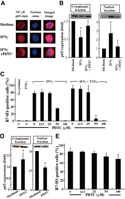 Figure 2. Inhibition of NF-κB activation down-regulated B7-H1 expression.(A) SKM-1 cells cultured for 24 hours with medium alone, IFNγ, or IFNγ and pyrrolidine dithiocarbamate (PDTC; 100μM) were stained for NF-κB p65 (red) and nuclei (blue). The merged image showed that IFNγ induced p65 localization into the nucleus, which was inhibited by PDTC. Images were acquired on an Olympus IX71 inverted microscope using a LCPlanFI 40×/0.60 objective lens. Alexa 594 and 4'-6-diamidino-2-phenylindole were detected using Fluorescence Miler Units of U-MWIG2 and U-MNUA2 (Olympus), respectively. Images were captured using a 3CCD digital color camera (Hamamatsu Photonics) through Aquacosmos Software. (B) After the cultures in A, SKM-1 cells were separated into cytoplasmic and nuclear fractions, and their p65 contents were analyzed by Western blotting to show representative (top panel) and quantified (bottom panel) data (mean + SD) of 3 experiments. In each experiment, the band intensity of cell fractions from SKM-1 cells cultured with medium alone was defined as 1. *P = .017 and .06 (left panel) and *P = .045 and .012 (right panel) compared with “the medium” and IFNγ and PDTC, respectively. (C) SKM-1 cells cultured with or without cytokine(s) and various concentrations of PDTC were analyzed for B7-H1 expression by FCM. (D-E) Using F-36P cells expressing B7-H1 constitutively, the same experiments as in panels B and C were performed, except that no cytokines were used. Data are from 3 experiments. *P = .015 for D (left panel) and *P < .0001 (right panel) compared with the medium.