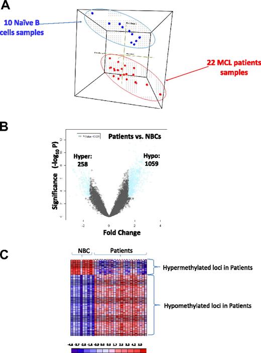Figure 1. The MCL genome is distinctly methylated compared with normal naive B cells. (A) Three-dimensional principal component analysis of DNA methylation data comparing MCL patient samples (red) and naive B cells (blue). (B) Plot of methylation difference (x-axis) vs significance (on y-axis) shows marked asymmetry with an overall tendency for hypomethylation in patients with MCL compared with NBCs. Blue dots mark probe sets that reached both criteria for differential methylation on our analysis (methylation difference of 1.5 and P < .001). (C) Methylation (HELP data) at the differentially methylated loci identified above from patients with MCL and NBCs represented in a heat map. Scale shows relative methylation (red indicates hypomethylation; blue indicates hypermethylation).