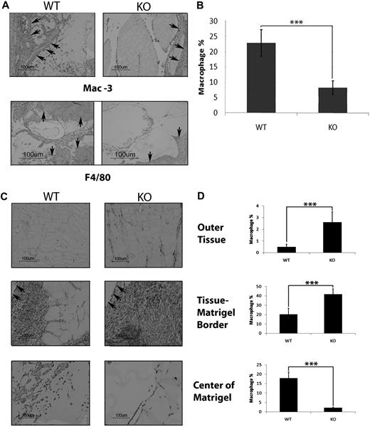 Figure 2. Macrophage recruitment into a Matrigel plug is decreased in S100A10−/− mice. WT and S100A10−/− mice were implanted with a Matrigel plug containing 200 ng/mL basic fibroblast growth factor and 60 U/mL heparin. Plugs were removed after 7 days, fixed in formalin, and processed for immunohistochemical analysis. Sections were deparaffinized and incubated with anti-Mac-3 (A top panel, C) and anti-F4/80 antibody (A bottom panel). Microscopic fields containing the entire Matrigel plug (B), outer tissue surrounding the plug, Matrigel-tissue border, and center of Matrigel (D) were quantified by determining the percentage coverage of macrophages in each region using ImageJ software. Results are expressed as percentage of macrophages per field plus or minus SD of 3 independent experiments. Statistical analysis was performed by Student t test: ***P < .001. Arrows indicate the Matrigel-tissue border.