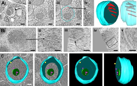 Figure 3. Gallery of platelet granules with different substructure. (A) Chemical fixed platelets. Panel of x-y slices, z-axis orientation, and 3D reconstructions of α-granule profile showing the eccentric localization of the 12-nm-wide tubules representing polymeric VWF assemblies. (Ai) x-y slice of a single VWF tubule (arrow). (Ai-iv) Multiple eccentrically localized VWF tubules (red dots in iii). Arrow indicates the same tubule in z-axis orientation. An animation is included as supplemental Video 4. (B) Panel of VWF tubules from HPF-FS platelets. (Bi-ii) The same polymeric VWF tubule in 2 different orientations. (Biii) A kinked VWF tubule (arrow). The VWF tubule in panel Biv (highlighted in Bv) reveals a helical-like substructure. (Ci-iv) Tomographic reconstruction of immunogold-labeled α-granule, double-labeled with anti–P-selectin (10-nm gold, indicated by yellow dot), and CD63 (15-nm gold, indicated by red dots). The 40- to 80-nm free luminal vesicles are distinct from the tubules shown in panels A and B. (Ai) Bars represent 100 nm. (Aii-iii′, Bi-iv) Bars represent 50 nm. (Bv) Bars represent 25 nm. (C) Bar represents 50 nm.