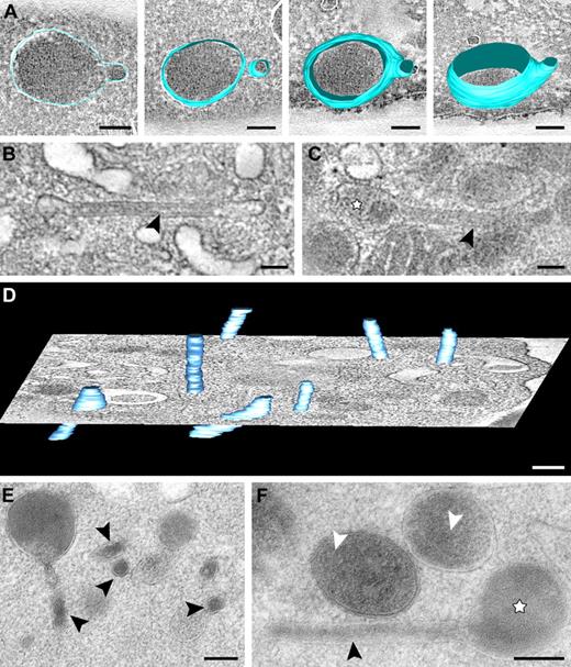Figure 4. Series of tomographic slices and 3D models of tubular granule subtypes. (A) Tomographic slice extracted from a semithin cryosection and reconstructed model showing spherical α-granule with developing extension. (B-C) z-axis orientations through tubular α-granule subtypes obtained from chemical fixed resting platelets. For details, see “Tomography and data analysis.” (B) Fibrillar protein densities (arrows) are apparent within the tubule. (C) Tubular profile connected to a spherical domain. (An animated model is included as supplemental Video 5.) (D) Tomographic slice and 3D model of multiple tubules (light blue) extracted from an approximately 300-nm section of a chemical fixed platelet. (E-F) Tubular and spherical granules extracted from HPF-FS platelets. (E) Several cross-sectioned tubules are shown (arrowheads). (F) Tubule (arrowhead) connected to a spherical granule (☆). White arrowheads indicate (obscured) luminal membranes within α-granule subtypes. Bars represent 100 nm.