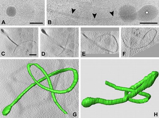 Figure 5. CET of whole vitrified platelet. (A-B) Snapshots extracted from a whole vitrified platelet in PRP, plunge frozen in liquid ethane. Spherical and extended granule subtypes are shown. (A) Note the difference in electron density of individual spherical granules. Luminal vesicles are visible in the granule on the righthand side of panel A. (B) Tubular profiles (arrowheads) are often connected to electron-dense spherical domains (☆). (C-F) Tomographic slices of a tubular granule subtype extracted from a vitrified platelet after single-axis tilting and low-dose recording at −5 μm defocus. The tubular strand is more than 7 μm long and exhibits a highly curved nature. (G) Reconstructed 3D model (top view) after manual surface rendering with IMOD software. (H) Side view (an animation is included as supplemental Video 6). Bars represent 100 nm.