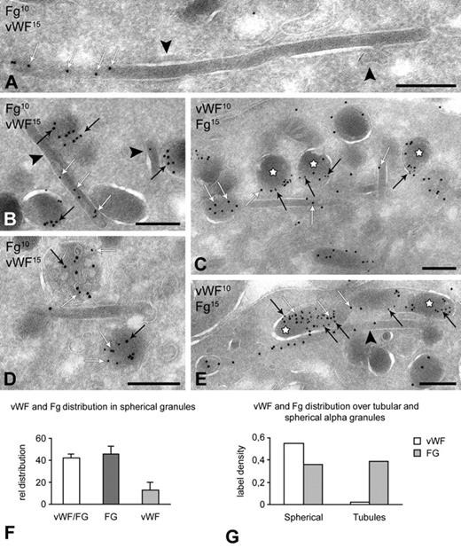 Figure 7. Segregation of VWF from tubular α-granules. Platelets were fixed for immunoelectron microscopy as described in “Blood collection and platelet preparation.” Immunogold double-labeling was performed on approximately 60-nm-thick cryosections using 10-nm and 15-nm protein-A gold and analyzed on a JEOL 1200CX electron microscope. (A-E) Immunogold double labeling of VWF and fibrinogen in tubular and spherical granules. Labeling as indicated on the figures. White arrows indicate fibrinogen; and black arrows, VWF. (A) Long tubular profile showing distinct fibrinogen labeling at one end. VWF is absent from the tubules. Clathrin lattices are indicated by the arrowheads. (B-E) Fibrinogen is distributed over both subtypes. VWF and fibrinogen colocalize in spherical (C,E, ☆) and multivesicular subtypes (D). Spheres exclusively containing fibrinogen are also prominent (B,E). Tubular profiles containing fibrinogen but no VWF are indicated by arrowheads in panels B and E. Note that the sequence of immunogold labeling in panels C and E is reversed. (F-G) Quantitative evaluation of the VWF and Fg distribution and colocalization over spherical and tubular subtypes (n = 1000 granules). Bars represent 200 nm.