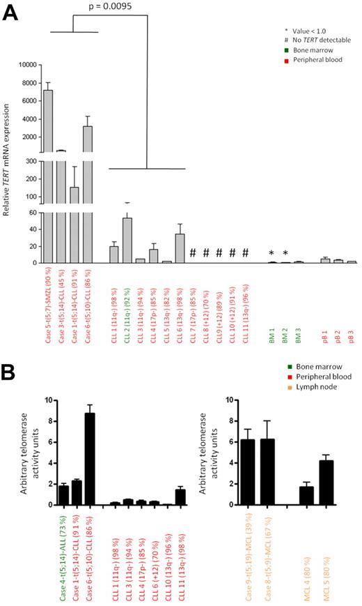 Figure 2. TERT expression and telomerase activity of B-cell malignancies with and without aberration in the TERT-CLPTM1L locus. (A) Relative TERT mRNA expression determined by qRT-PCR. Cases 1, 3, 5, and 6 with 5p15.33 break by FISH were compared with CLL 1-11 showing no 5p15.33 aberration by FISH. The P value was estimated using the Mann-Whitney test. Samples with undetectable TERT mRNA expression were excluded from statistical analysis. (B) Telomerase activity measured by TRAP assay. Cases 1, 4, and 6 and cases 8 and 9 with 5p15.33 aberration by FISH were compared with CLL cases 1, 3, 4, 6, 10 and 11 and MCL cases 4 and 5 without aberration in this region by FISH. The relevant cytogenetic aberrations and the tumor cell contents are given in brackets.