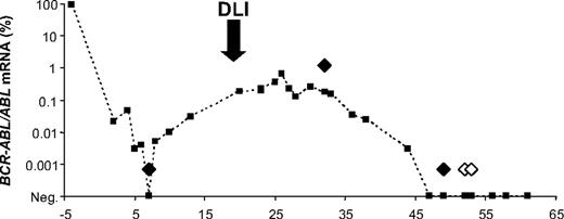 Figure 2. Representative pattern of residual disease found in patients tested early after SCT, at relapse and post-DLI. One of 3 patients tested, all with similar patterns, is shown. On the x-axis are months post–stem cell transplantation (SCT). The results of the quantitation of BCR-ABL transcripts (■) are expressed as the ratio of BCR-ABL to ABL mRNA (y-axis, in a logarithmic scale). The results of the RQ-PCR for gBCR-ABL are represented as diamonds: ♦, gBCR-ABL–positive; ◆, gBCR-ABL–negative. gBCR-ABL was detected in a transcript-negative sample prerelapse and at relapse; after donor lymphocyte infusion (DLI), a transcript-negative sample was gBCR-ABL–positive; later samples were gBCR-ABL–negative.