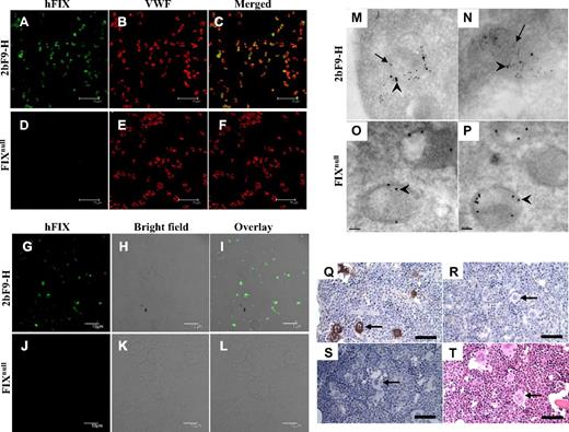 Figure 3. Immunostaining of FIX in 2bF9 mice. (A-F) Confocal microscopy study of FIX in platelets. Platelets isolated from 2bF9-H (A-C) and FIXnull mice (D-F) were immunofluorescently stained for FIX (green) and VWF (red). The merged images (C,F) show that FIX was expressed in 2bF9 transgenic platelets and colocalized with VWF. Bars represent 15 μm. (G-L) Confocal microscopy study of FIX in mononuclear cells. Mononuclear cells and platelets isolated from 2bF9-H (G-I) or FIXnull (J-L) mice were stained for FIX (green). FIX was detected in 2bF9-H platelets, but no FIX was detected in mononuclear cells. Bars represent 10 μm. (M-P) Immunoelectron microscopy study of FIX in platelets. Platelets from 2bF9-H (M-N) and FIXnull mice (O-P) were immunogold stained for FIX (5-nm colloidal gold, indicated by arrows) and VWF (10-nm colloidal gold, indicated by arrowheads). FIX colocalized with VWF in α-granules. Bars represent 100 nm. (Q-T) Femoral marrow from 2bF9-H (Q,S-T) and FIXnull mice (R) were immunostained for FIX (Q-R) or with an isotype control (S). 2bF9-H marrow was also stained with hematoxylin and eosin (T) to demonstrate the morphology of megakaryocytes. FIX protein was demonstrated in megakaryocytes of 2bF9-H mice. Arrows point to representative megakaryocytes in each figure. Bars represent 50 μm. These results demonstrate that FIX was expressed in platelet lineage cells and stored in the platelet α-granules of 2bF9 transgenic mice. Confocal images (A-L) were acquired using an Olympus FV-1000-MPE Multiphoton Confocal Microscope (Olympus Corporation) with a 100×/1.4 NA oil objective with 2×digital zoom into Imaging Software FV10-ASW Version 2.00a (Flowview Software) using Vectashield Mounting Medium (Vector Labs). Cofocal specimens were mounted using Vectashield Mounting Medium (Vector Labs). EM images (M-P) were acquired using a JEOL JEM2100 Electron Microscope (JEOL USA Inc.) at 100 000× magnification with a Gatan Ultrascan 1000 CCD Camera (Gatan Inc) into Digital Micrograph Software Version GMS 1.8.4 (Gatan Inc). Immunohistochemistry images (Q-T) were acquired using a Nikon Eclipse E600 Microscope (Nikon) with a 40×/0.75 NA objective using a SPOT Insight Firewire Color Mosaic Model 11.2 Digital Camera (SPOT Insight Solutions) into SPOT Software Version 4.1. Immunohistochemistry specimens were mounted using Mounting Medium (Pierce).