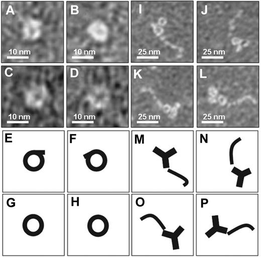 Figure 1. Electron microscopy analysis of β2GPI. Purified human plasma β2GPI was visualized with electron microscopy. (A-D) Magnifications of purified plasma β2GPI show a circular conformation. (E-H) Representation of panels A through D, respectively. (I-L) Purified plasma β2GPI in the presence of antibodies directed against domain I of β2GPI shows on magnification an open fishhook-like shape of β2GPI. (M-P) Representation of panels I through L, respectively.